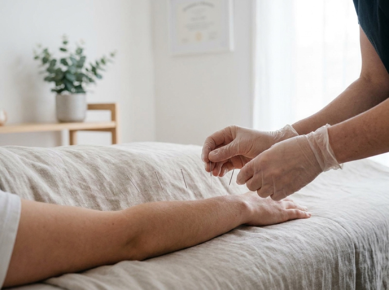 Heilpraktiker behandelt Patientin mit Akupunktur in ruhiger Praxisumgebung